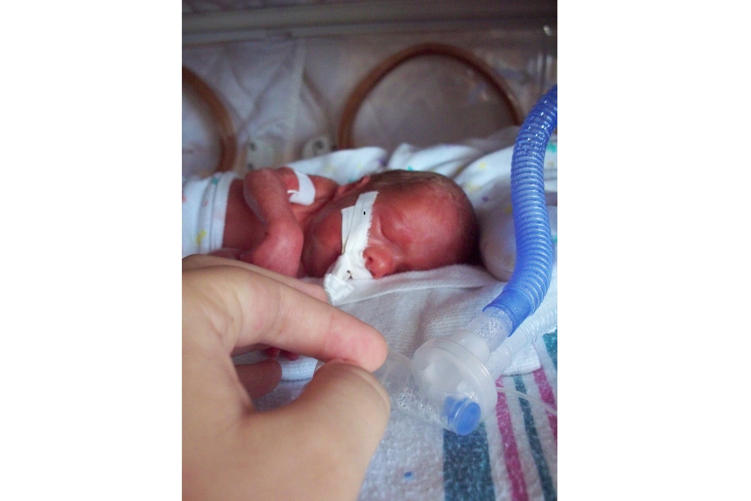 Sopravvissuti all’aborto – La vita dei neonati non è un diritto umano? 1