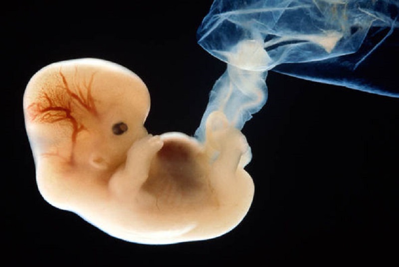 Bambino_6 settimane_aborto_embrione_feto