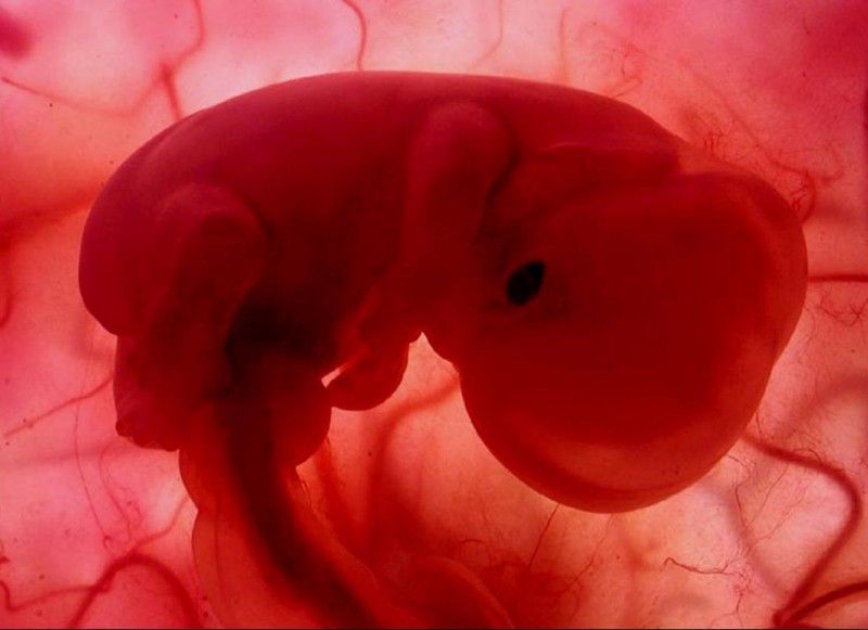 aborto _feto_bambino_vita_Michelino