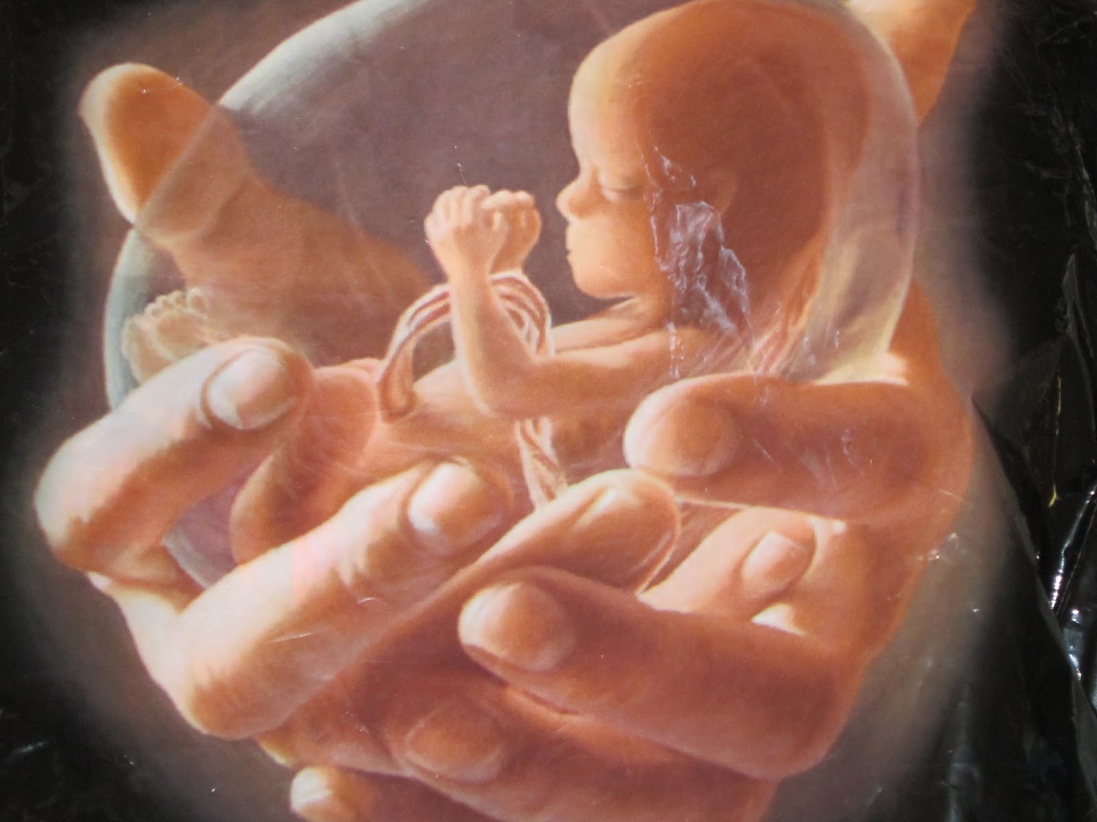 Aborto: “Perché no?” 1