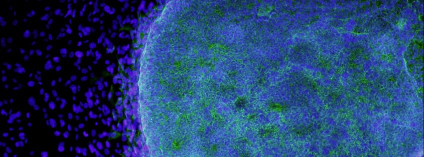 California – Fondi per la sperimentazione sulle cellule staminali embrionali 1
