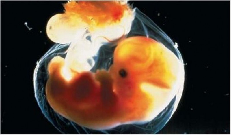 embrione umano_cellule staminali_vita_aborto