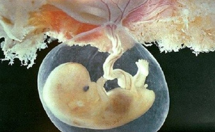 embrione_difesa_concepimento_natura_aborto_vita