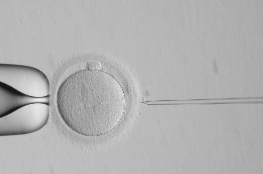 L’ Inghilterra scopre la strage degli embrioni 1