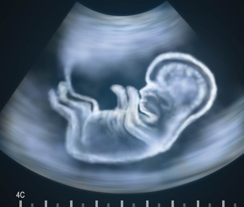 sviluppo feto_aborto_diritto alla vita_ donna